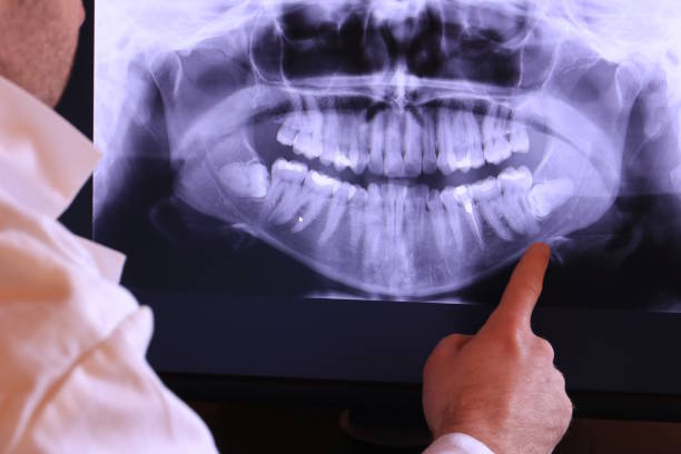 Best Root Canal Emergency Dentist  in Mountain Home, ID